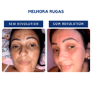 Rvo Revolution Alobela - 30 Aplicações