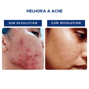 Rvo Revolution Alobela - 30 Aplicações