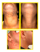 Folipro Sérum Clareador