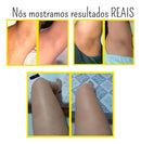 Folipro Sérum Clareador