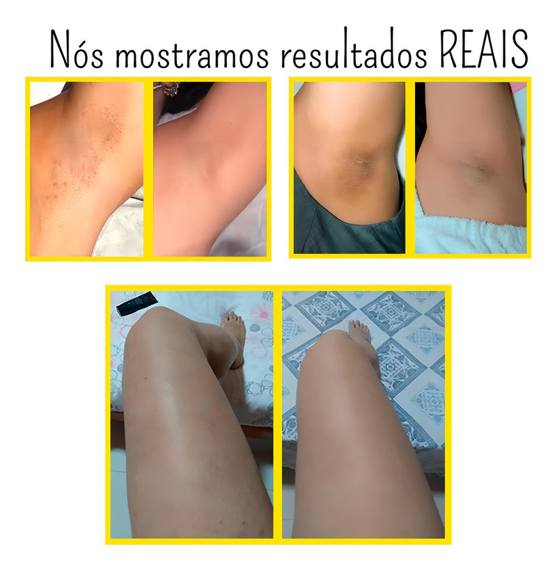 Folipro Sérum Clareador