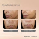 Melaclear Isdin Clareador