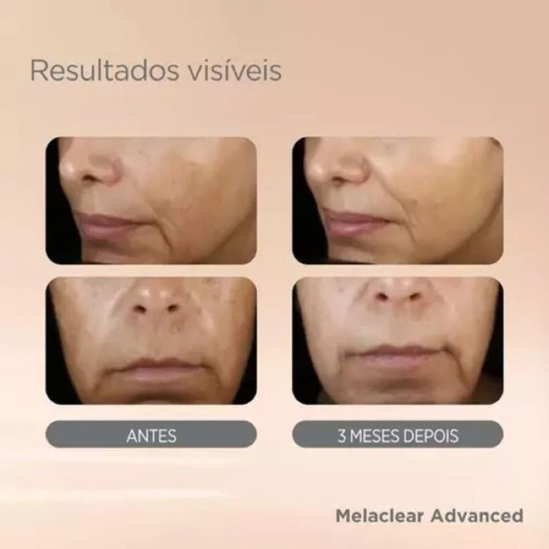 Melaclear Isdin Clareador